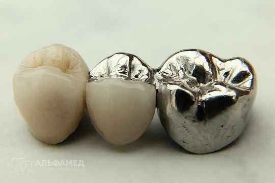 Фасетка стальная индивидуального литья (фасетка)