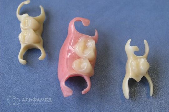 Микропротез нейлоновый